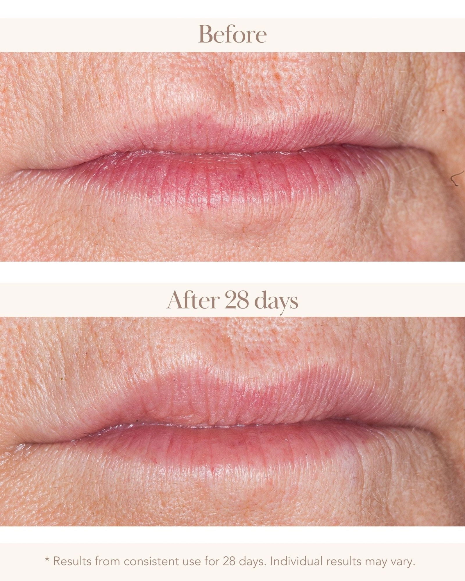 Collagen Re-Inforce 3D Anti-Wrinkle Lift & Plump Lip Serum - Elizabeth Grant Skin Care