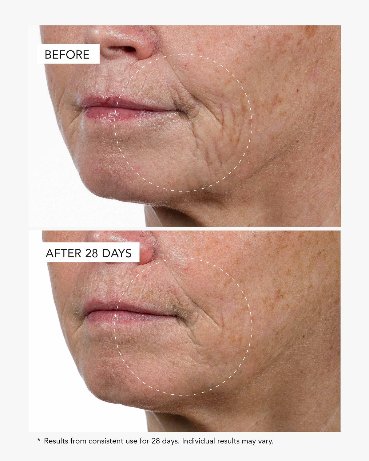 Before-and-after comparison of a woman&