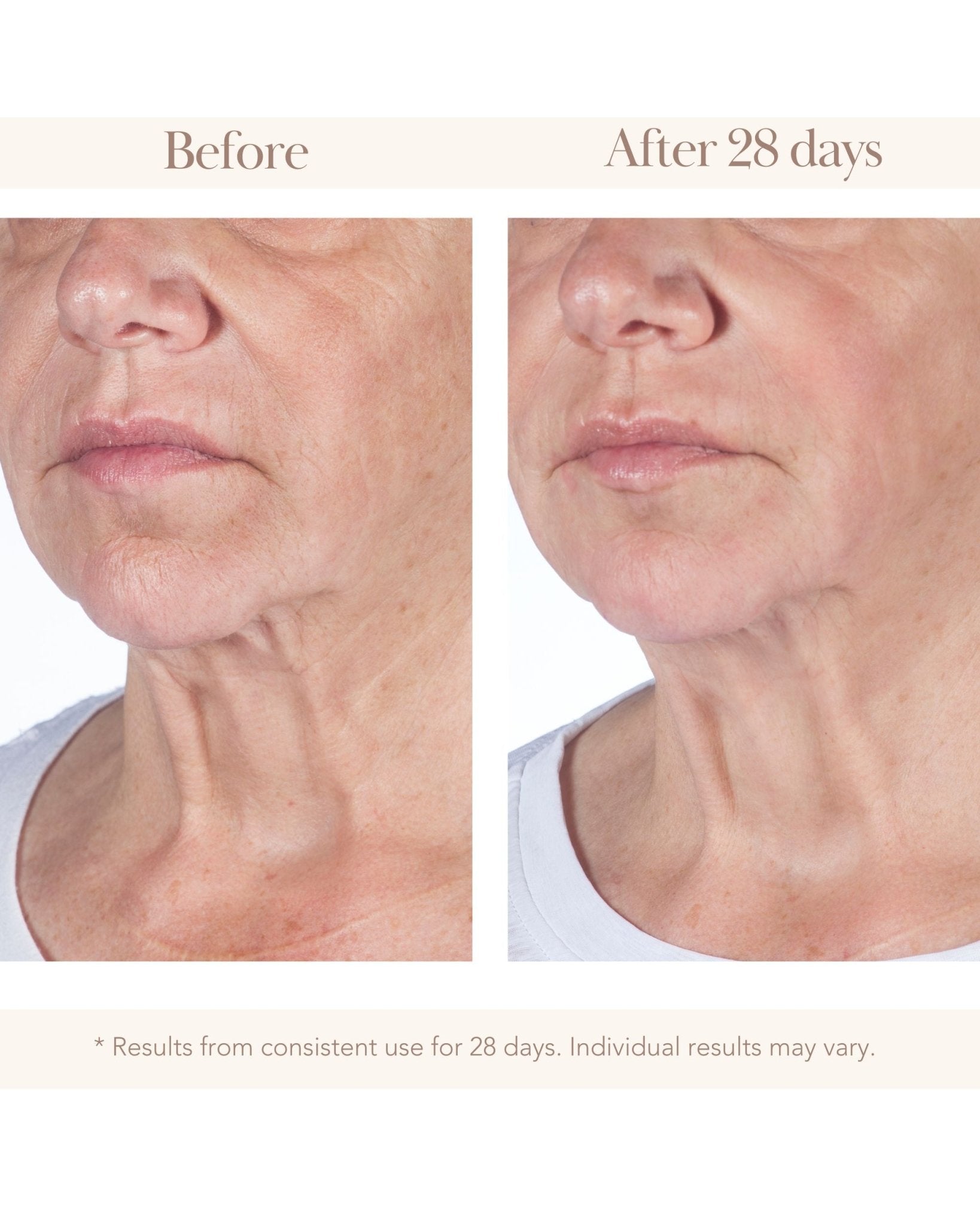 Professional Institute Hyaluron Serum - Elizabeth Grant Skin Care