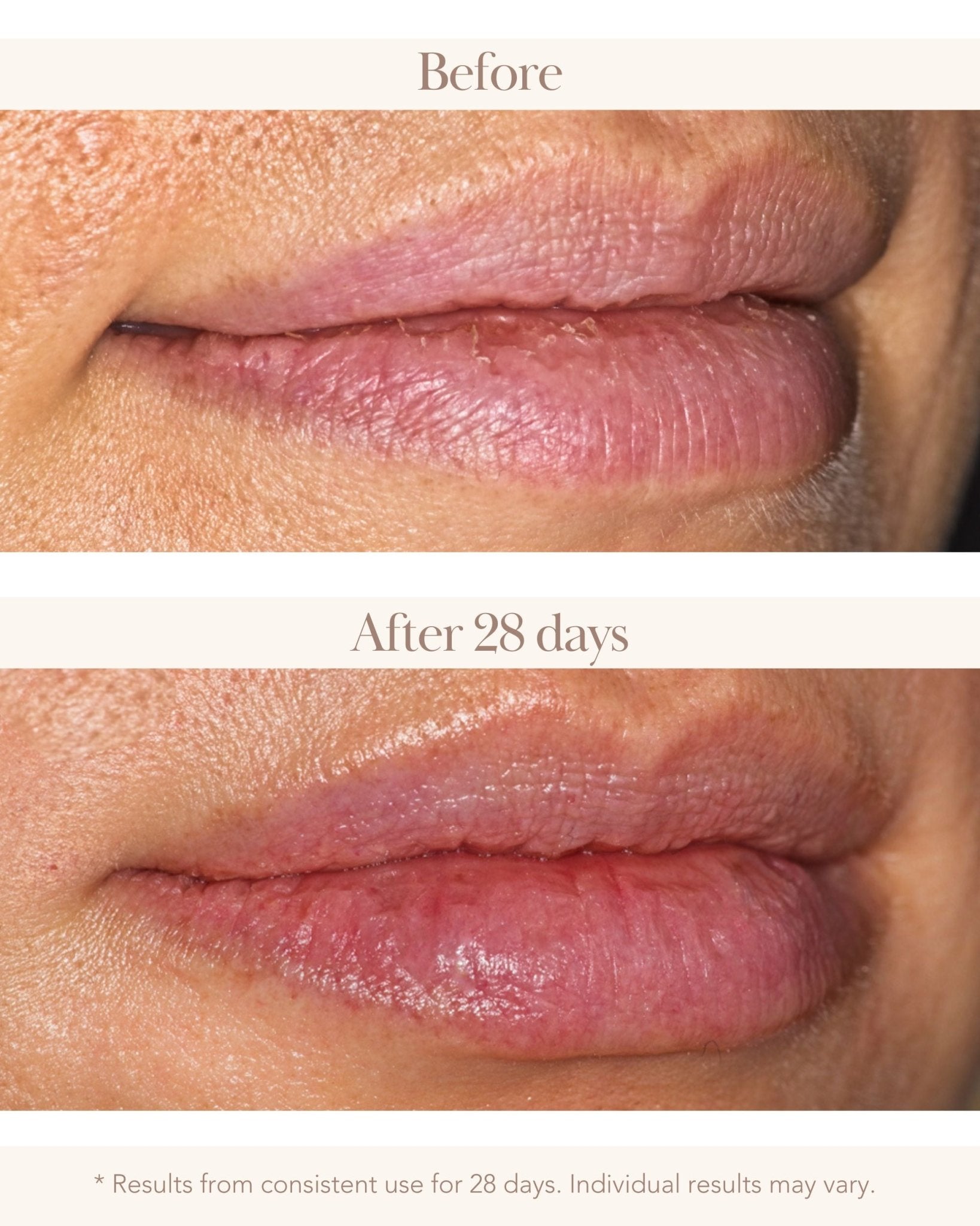 Torricelumn Absolute Nourishing Lip Mask - Elizabeth Grant Skin Care