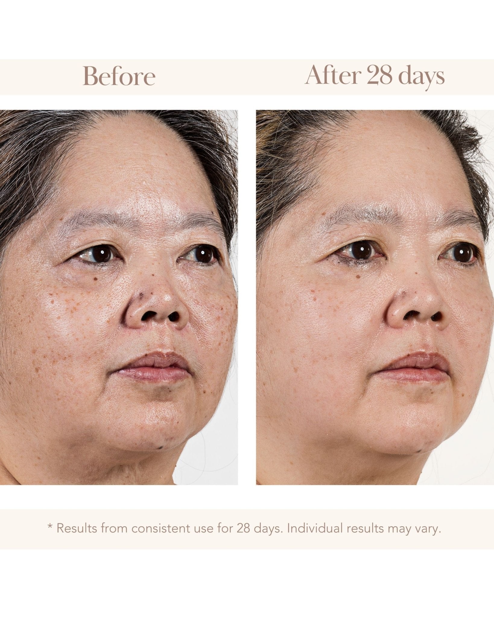 Vitamin C Gold C Dark Spot Corrector - Elizabeth Grant Skin Care