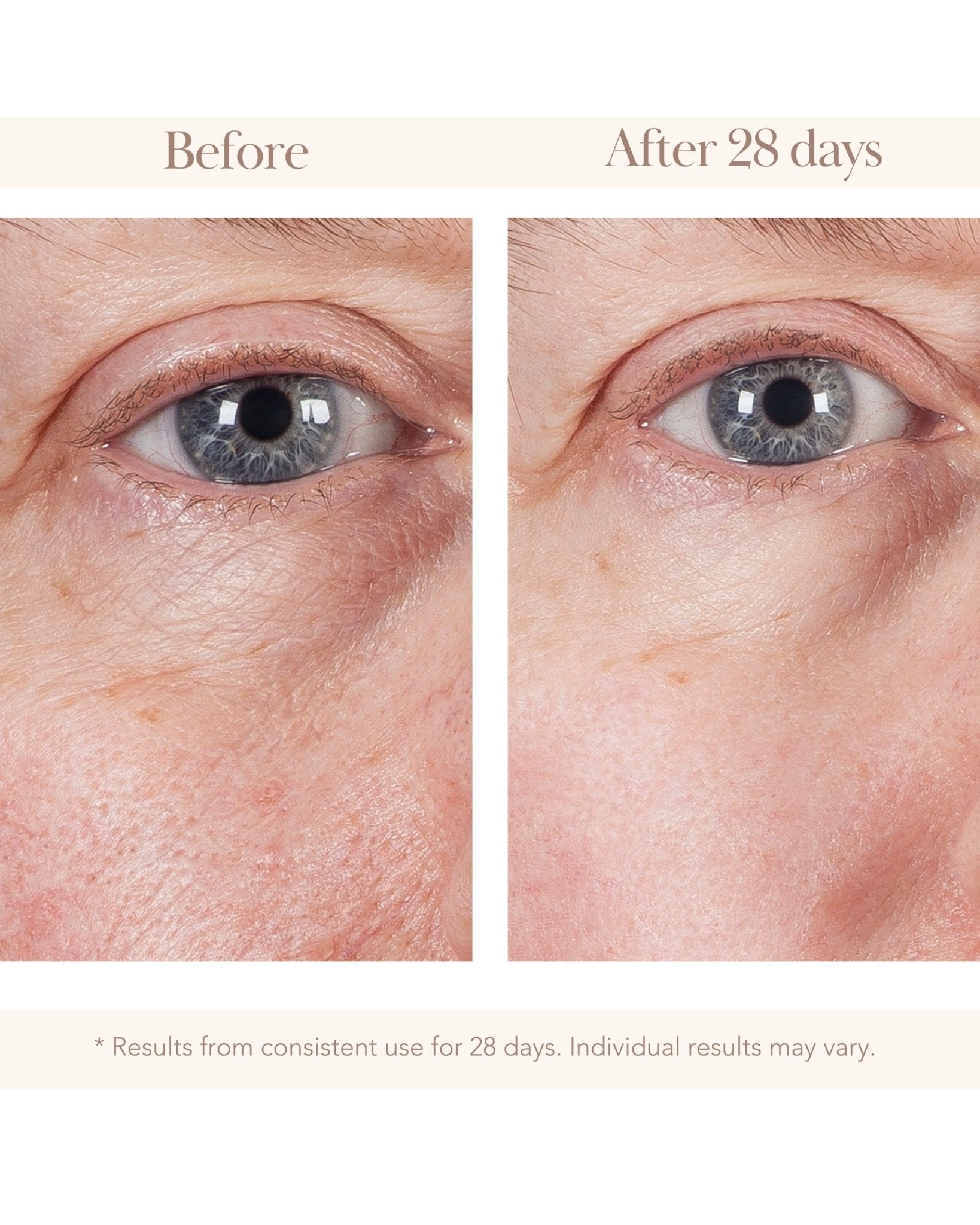 Vitamin C Gold C Eye Cream - Elizabeth Grant Skin Care