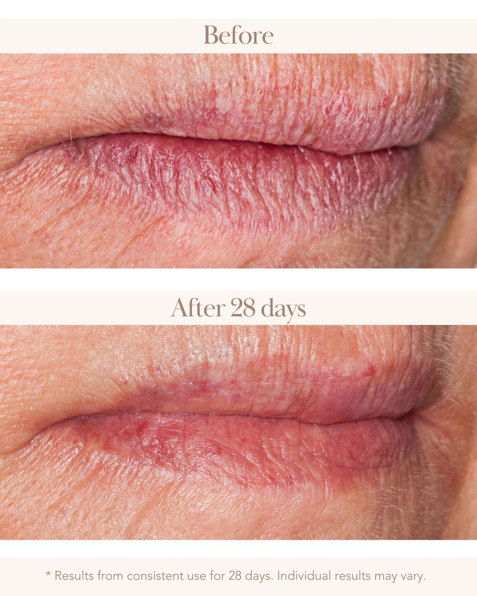 Caviar Nutruriche Lip Butter - Elizabeth Grant Skin Care