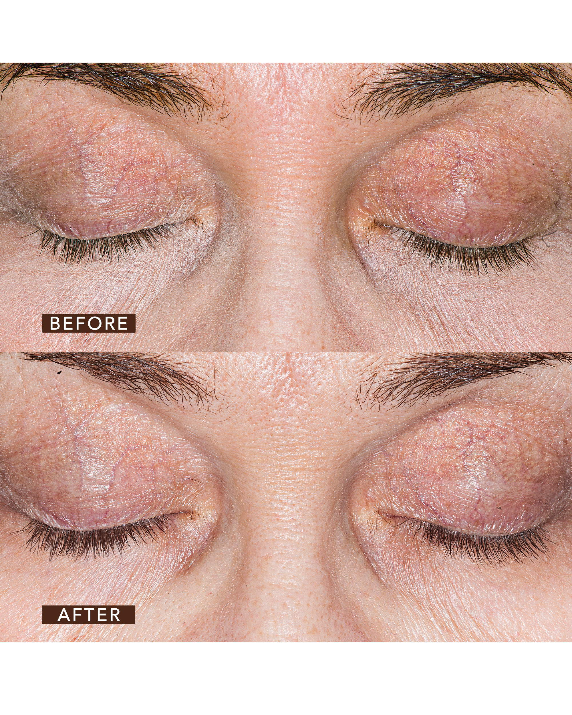 Professional Institute Thinning Eye Lash and Brow Solution