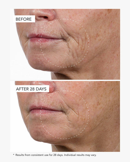 Before-and-after comparison of a woman&