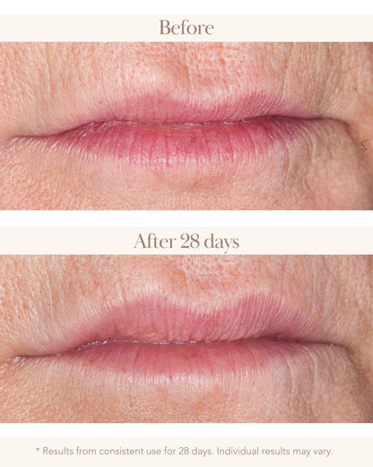 Collagen Re-Inforce 3D Anti-Wrinkle Lift &amp; Plump Lip Serum - Elizabeth Grant Skin Care
