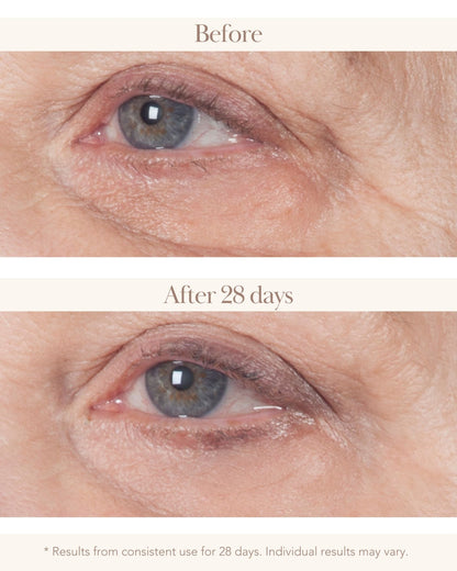 Collagen Re-Inforce 3D Crepey Eye Lift - Elizabeth Grant Skin Care