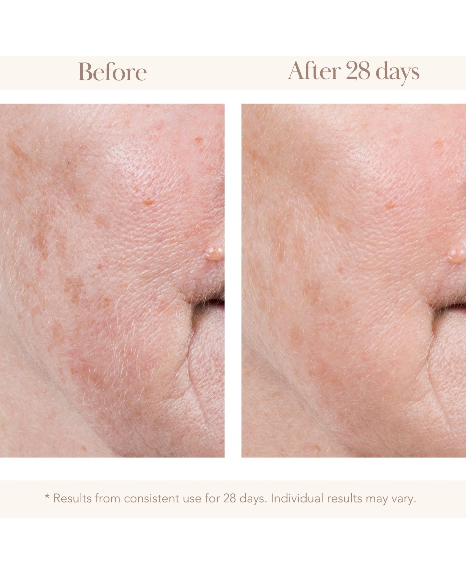 Royale Imperial Honey Concentrated Serum - Elizabeth Grant Skin Care