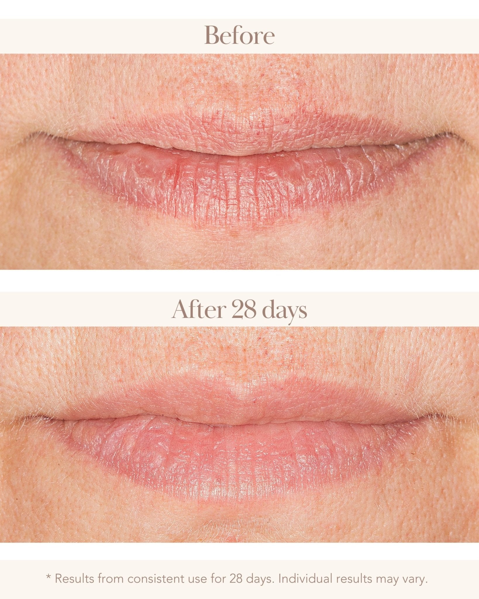 Royale Imperial Honey Lip Balm - Elizabeth Grant Skin Care