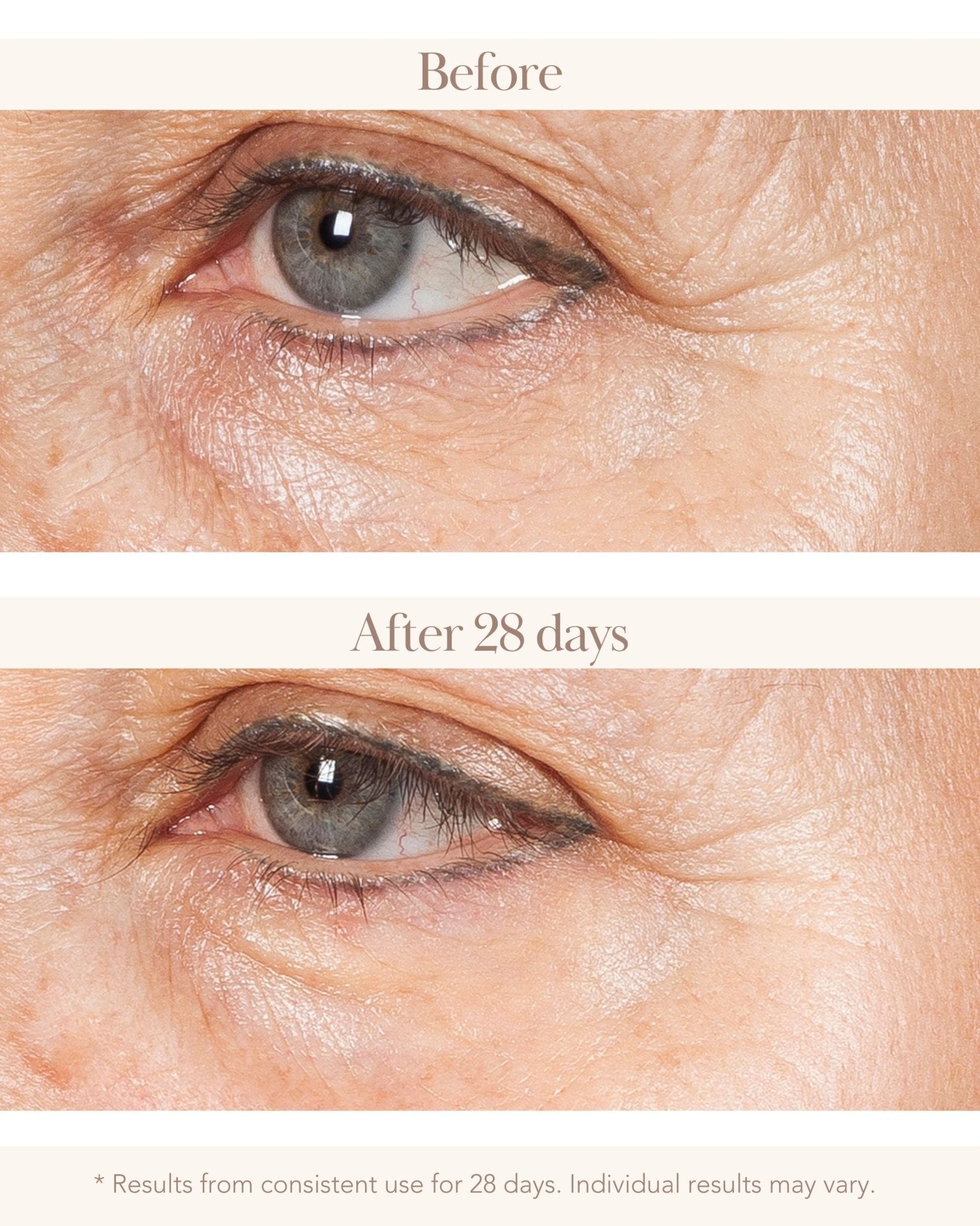 Torricelumn Absolute Miracle 02 Eye Serum - Elizabeth Grant Skin Care