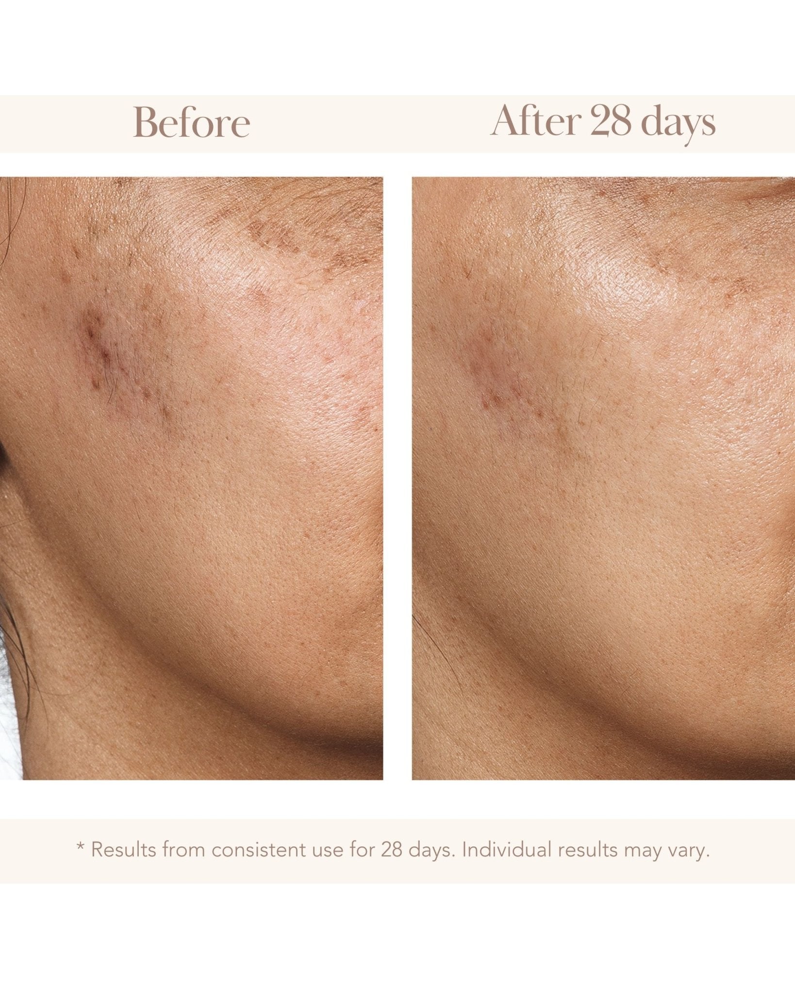 Vitamin C Gold C Concentrate Serum - Elizabeth Grant Skin Care