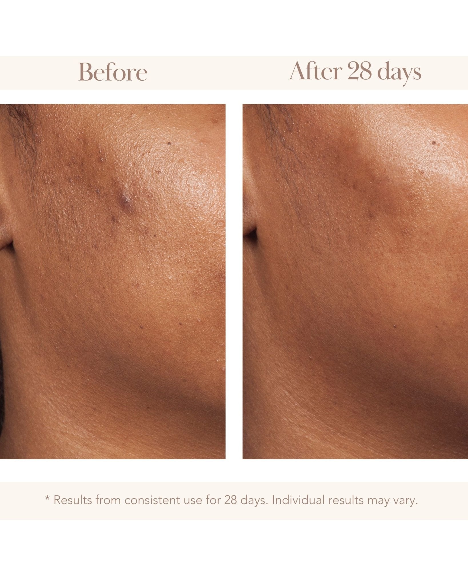 Wonder Effect Advanced Retinol Day Cream - Elizabeth Grant Skin Care