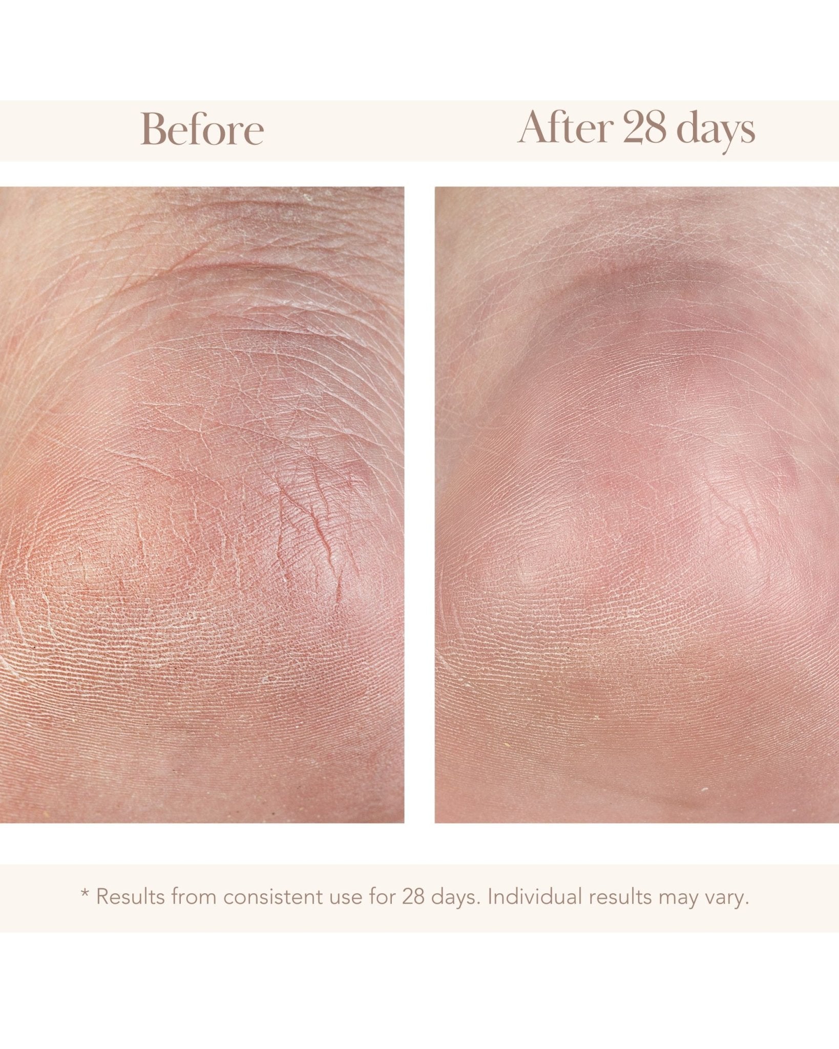 Wonder Effect Foot Cream with Silver - Elizabeth Grant Skin Care