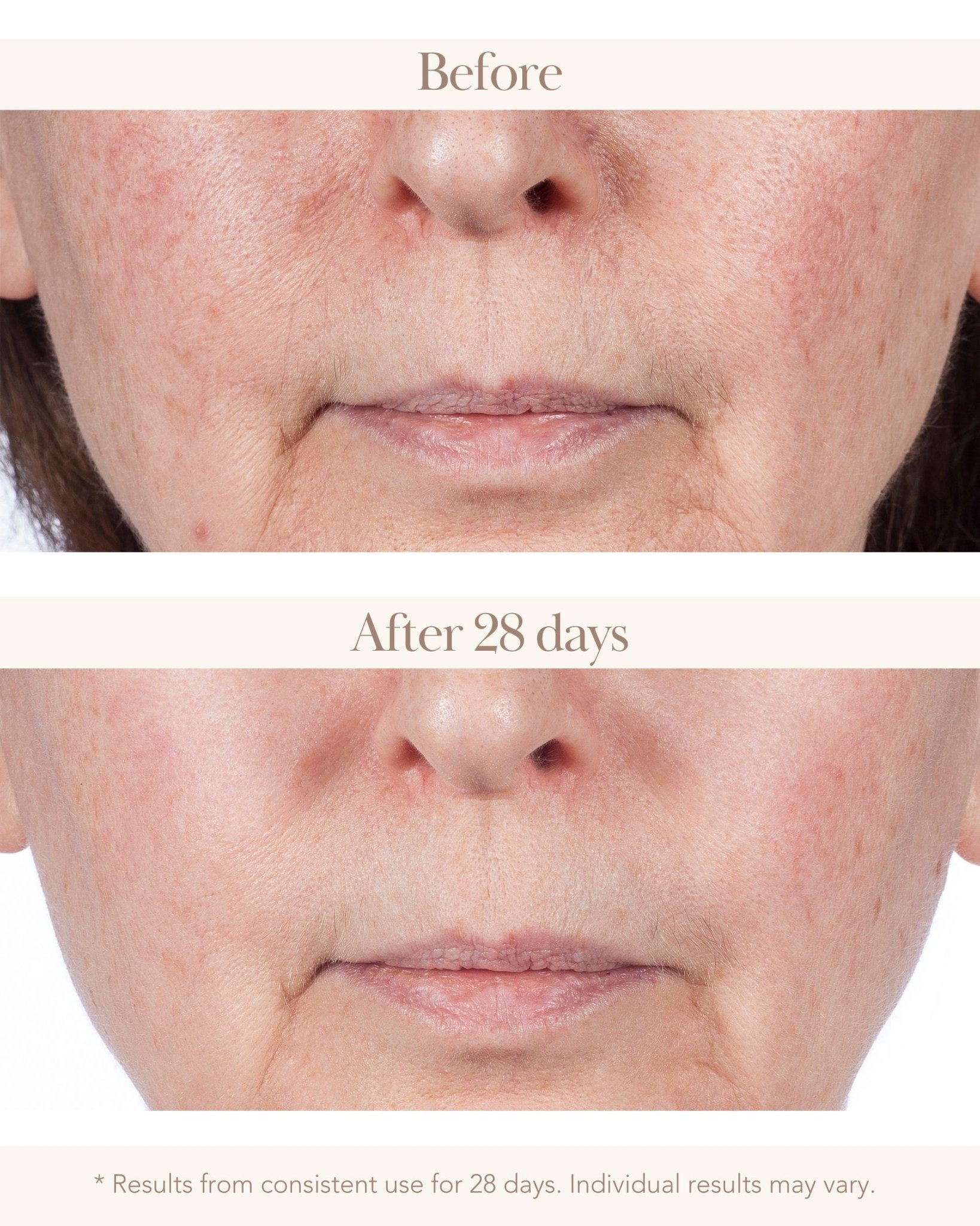 Wonder Effect Retinologist Refining Serum - Elizabeth Grant Skin Care